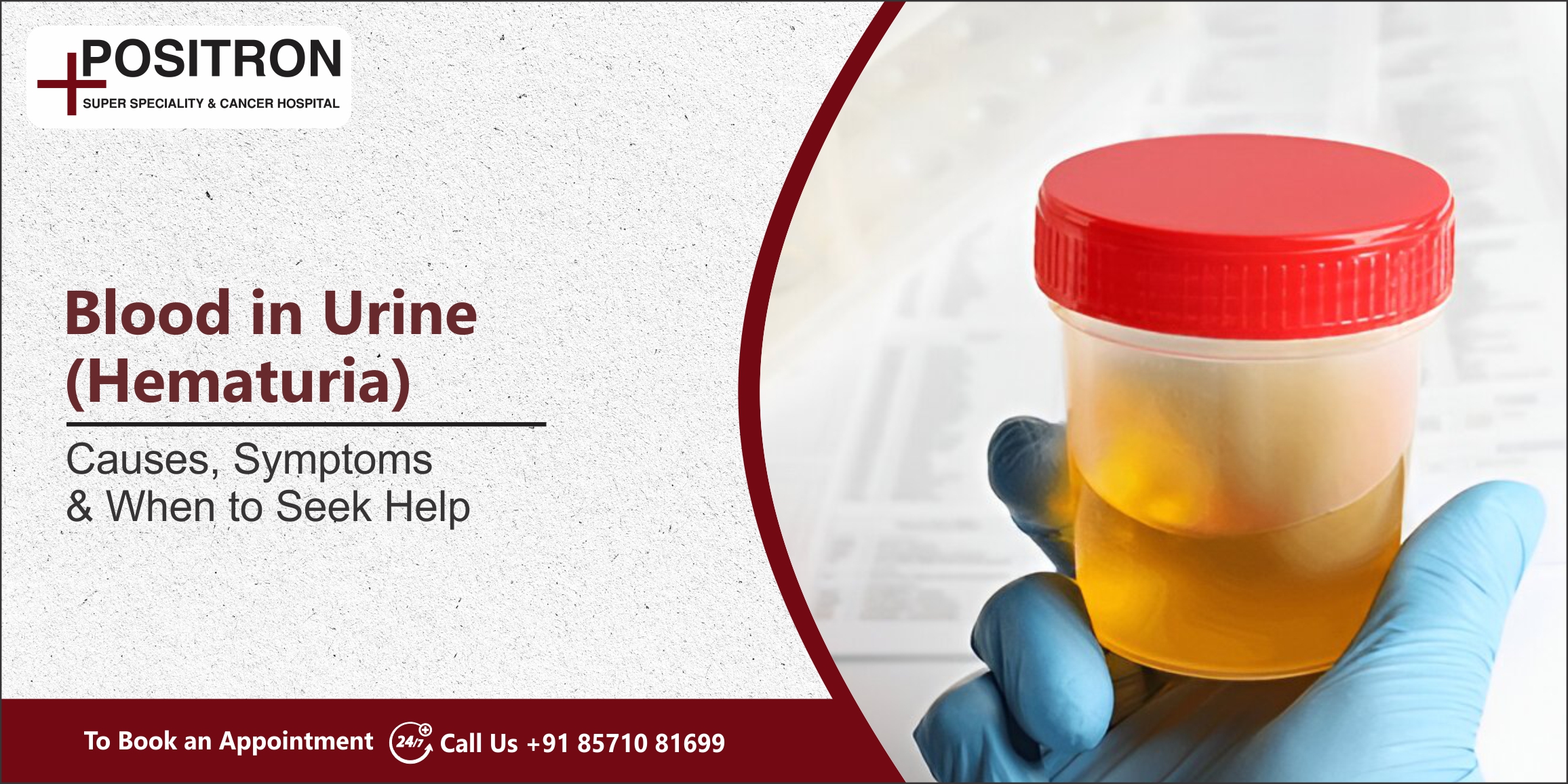 Blood in Urine (Hematuria): Causes, Symptoms & When to Seek Help